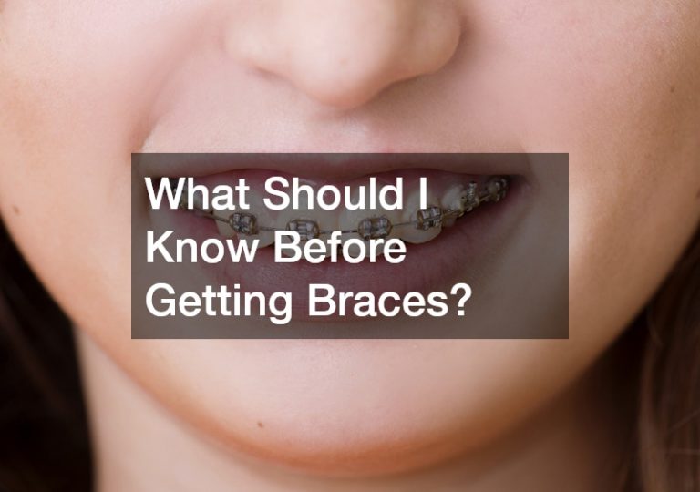 What Should I Know Before Getting Braces?