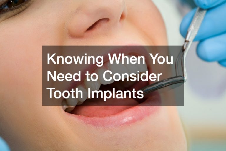 Knowing When You Need to Consider Tooth Implants