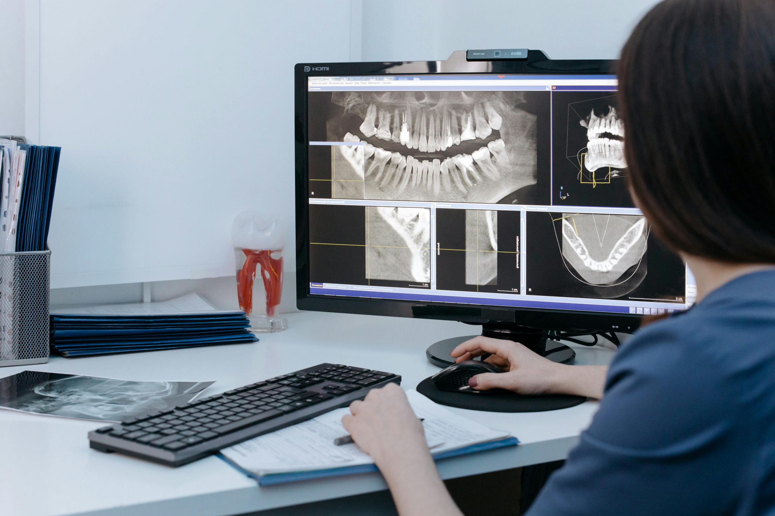 dentist examining a full-mouth x-ray on a monitor